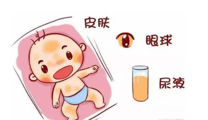  孕妇吃什么婴儿没有黄疸?黄疸的原因是什么?